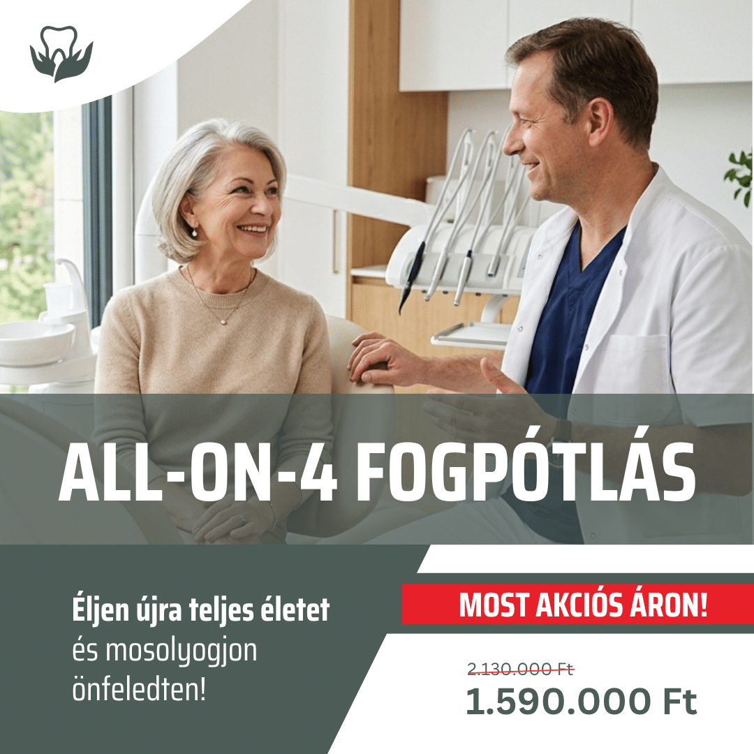 all-on-4 fogpotlas akcio